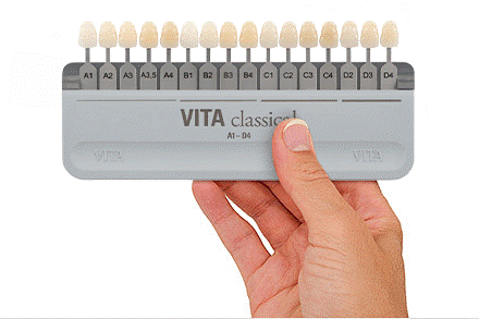 VITA Shade Guide VITA Shade Guide